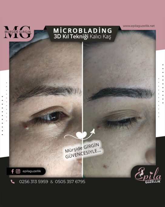 Nazilli - Microblading 3D Kıl Tekniği Kalıcı Kaş Kontürü