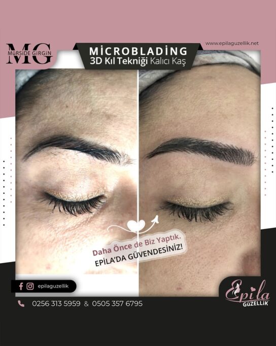 Nazilli - Microblading 3D Kıl Tekniği Kalıcı Kaş Kontürü