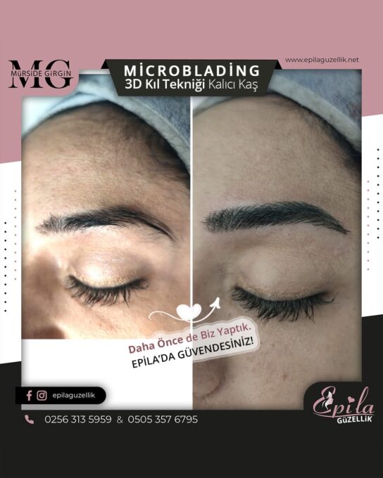 Nazilli - Microblading 3D Kıl Tekniği Kalıcı Kaş Kontürü