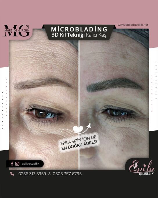 Nazilli - Microblading 3D Kıl Tekniği Kalıcı Kaş Kontürü