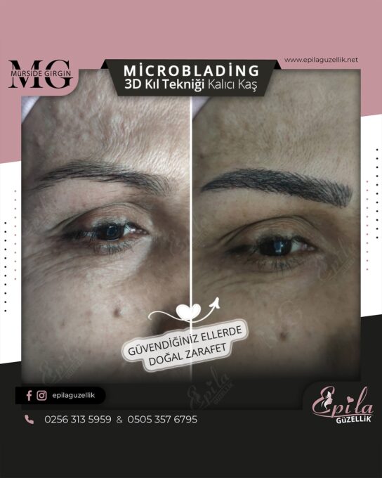 Nazilli - Microblading 3D Kıl Tekniği Kalıcı Kaş Kontürü