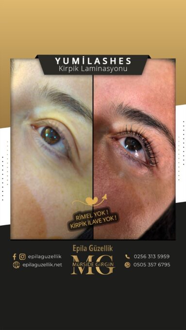 Nazilli - YumiLashes Kirpik Bakımı