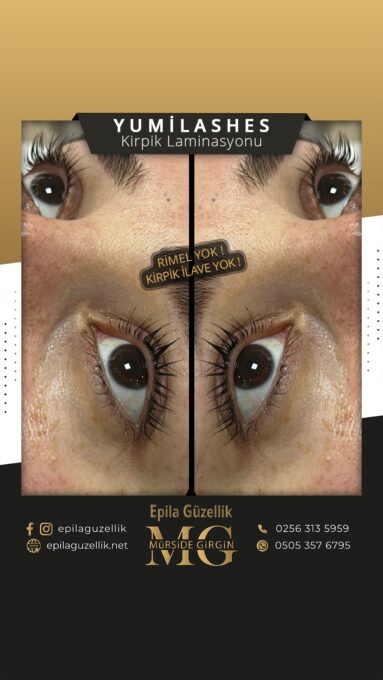 Nazilli - YumiLashes Kirpik Bakımı